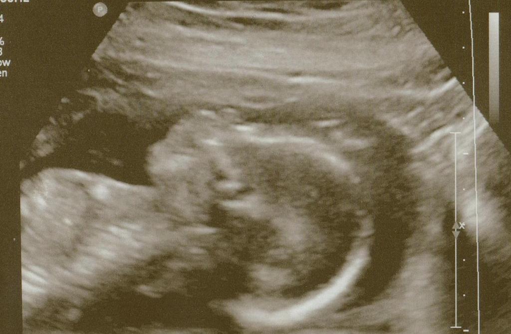 And It’s A…..