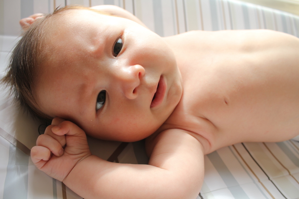 Heat Rash: The Hot Weather is Not&nbsp;Cool